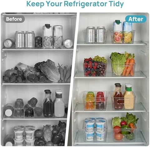 Vtopmart 8pcs Clear Storage Bins with Handles - Image 5